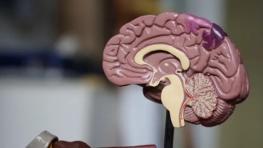 Foto de um cérebro em estudo sobre Alzheimer 
