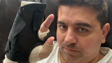 Buddy Valastro exibindo sua mão enfaixada após cirurgia 