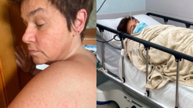 Montagem de fotos de Claudia Rodrigues com manchas pelo corpo e em cama de hospital 