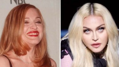 Madonna antes e depois 