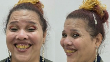 Montagem de fotos de Gorete do Pânico sorrindo antes de transformação 