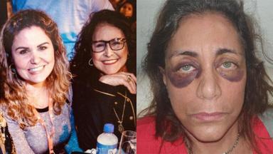 Karen Keldani, ao lado da cantora Joanna (primeira foto), agrediu a mãe, Nely Habib 