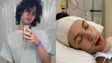 Lucas Jagger faz senfie antes da cirurgia e após, deitado em leito hospitalar, de olhos fechados e cabeça enfaixada 