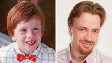  Michael Oliver antes e depois 