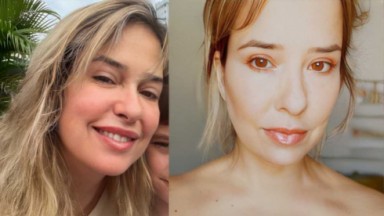 Palomma Duarte surge com o rosto inchado em foto publicada no Instagram 