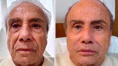 Antes e depois de Stênio Garcia 