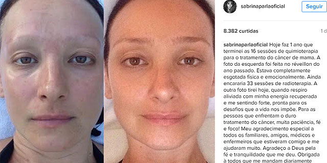 Ex-VJ Sabrina Parlatore posta foto antes e depois das sessões de quimio