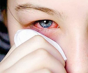alergia-ocular-foto.jpg