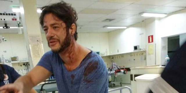 Igor Cotrim se pronuncia após ser agredido por bandidos em Belo Horizonte