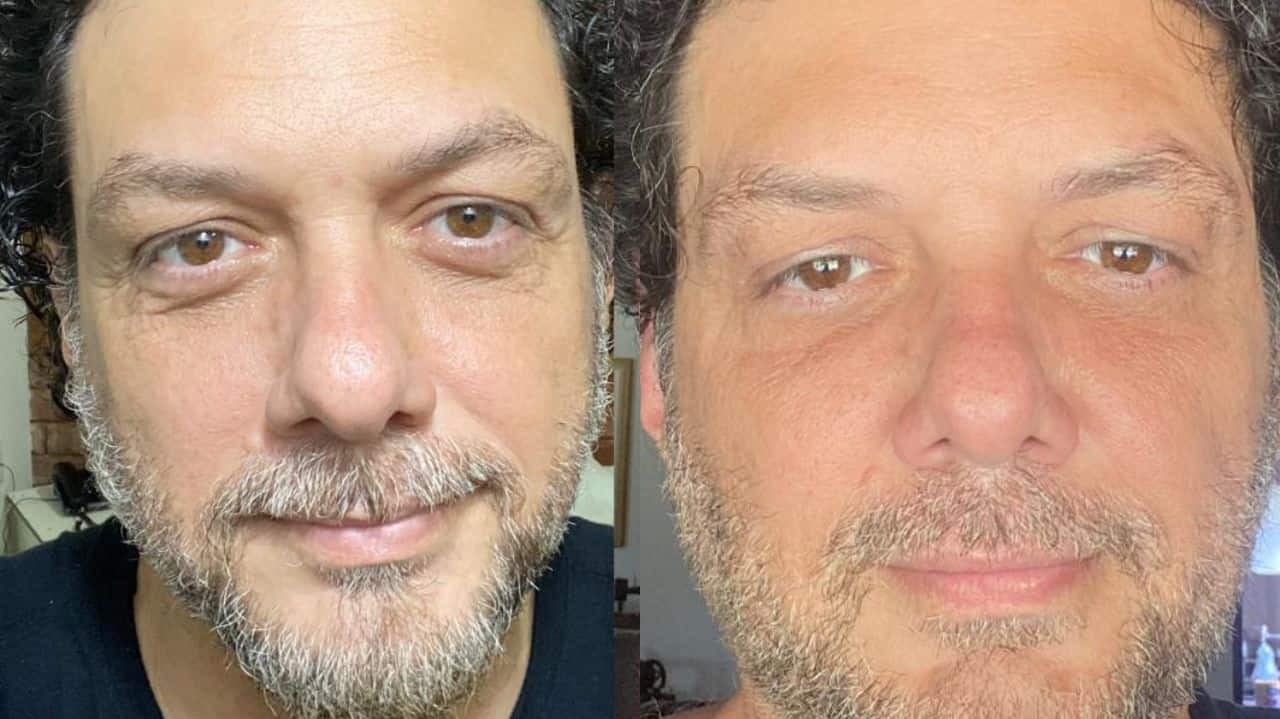 Antes e depois de Roobertchay Rocha