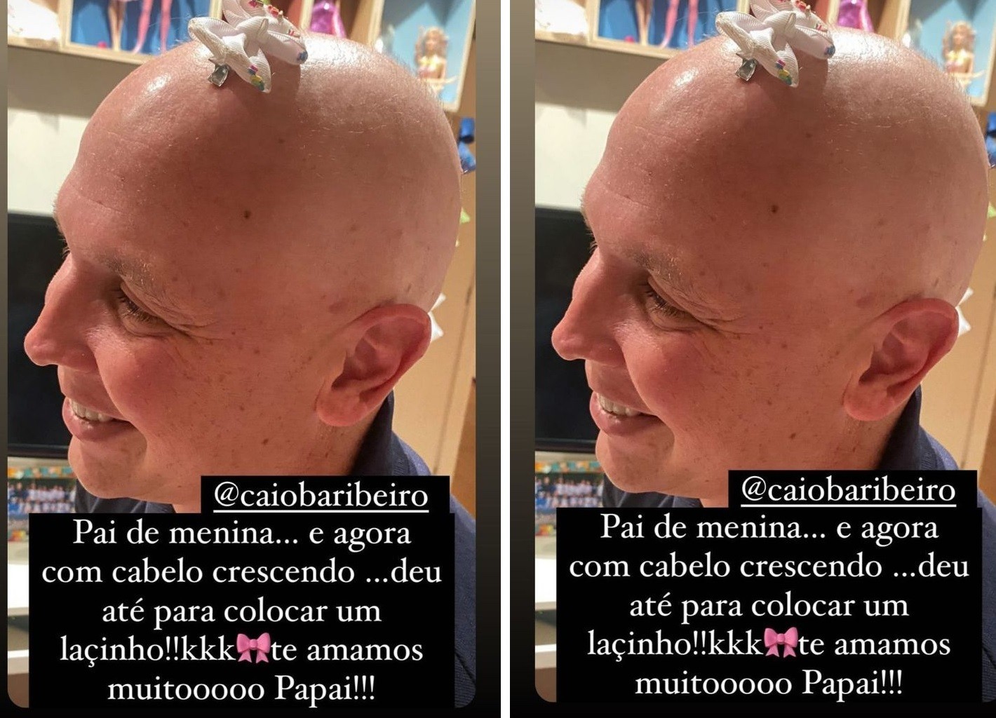 Caio Ribeiro posa com lacinho em recuperação do câncer