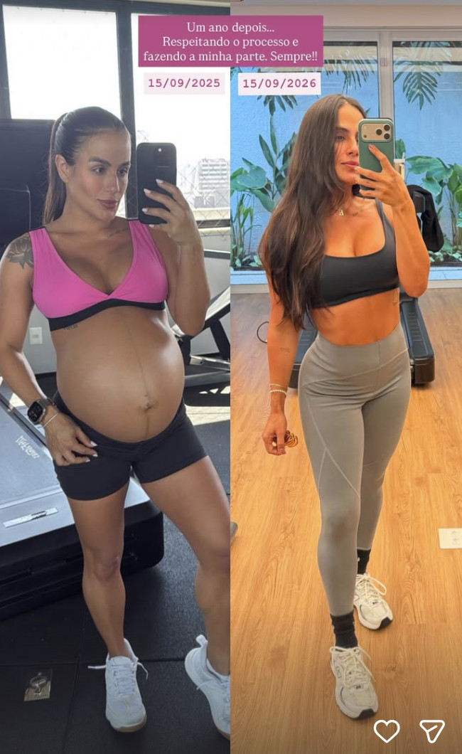 Carol Peixinho mostra antes e depois do corpo um ano após gravidez