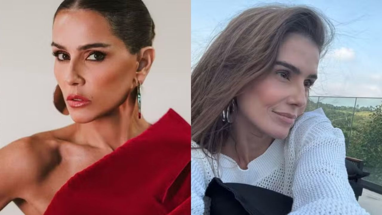 Voltaram atrás: 7 famosas que reverteram procedimentos faciais