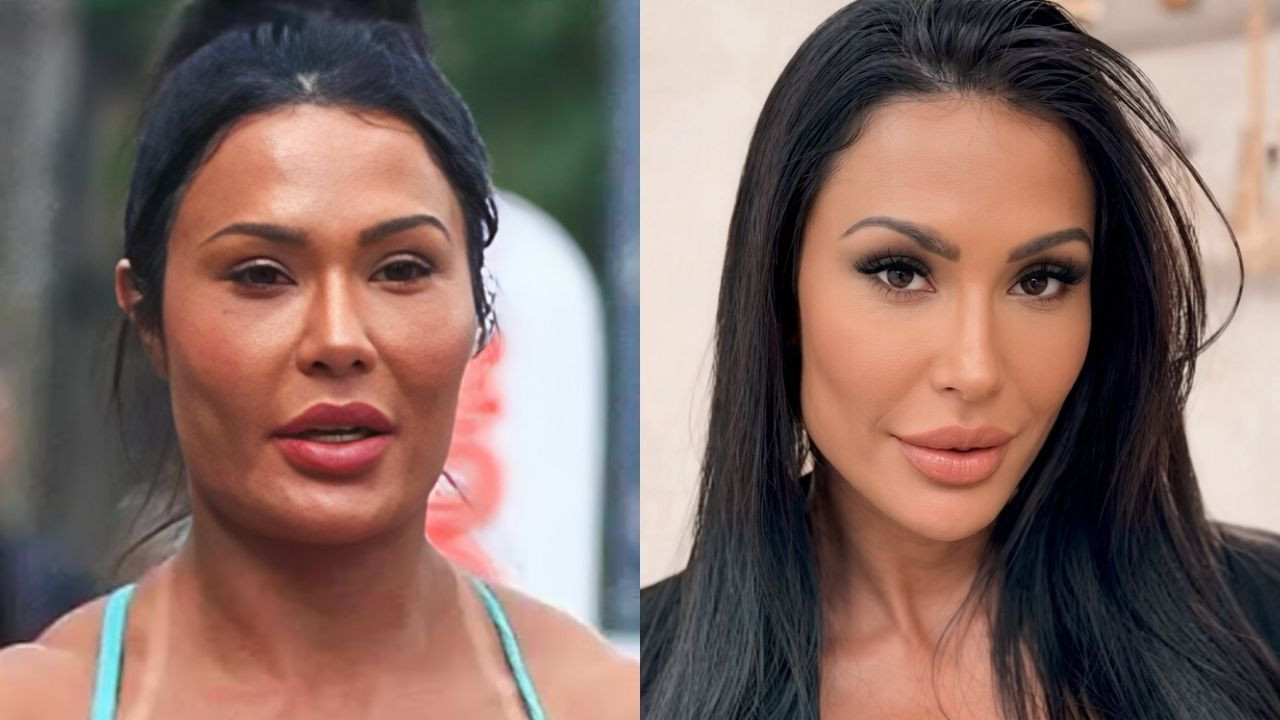Voltaram atrás: 7 famosas que reverteram procedimentos faciais