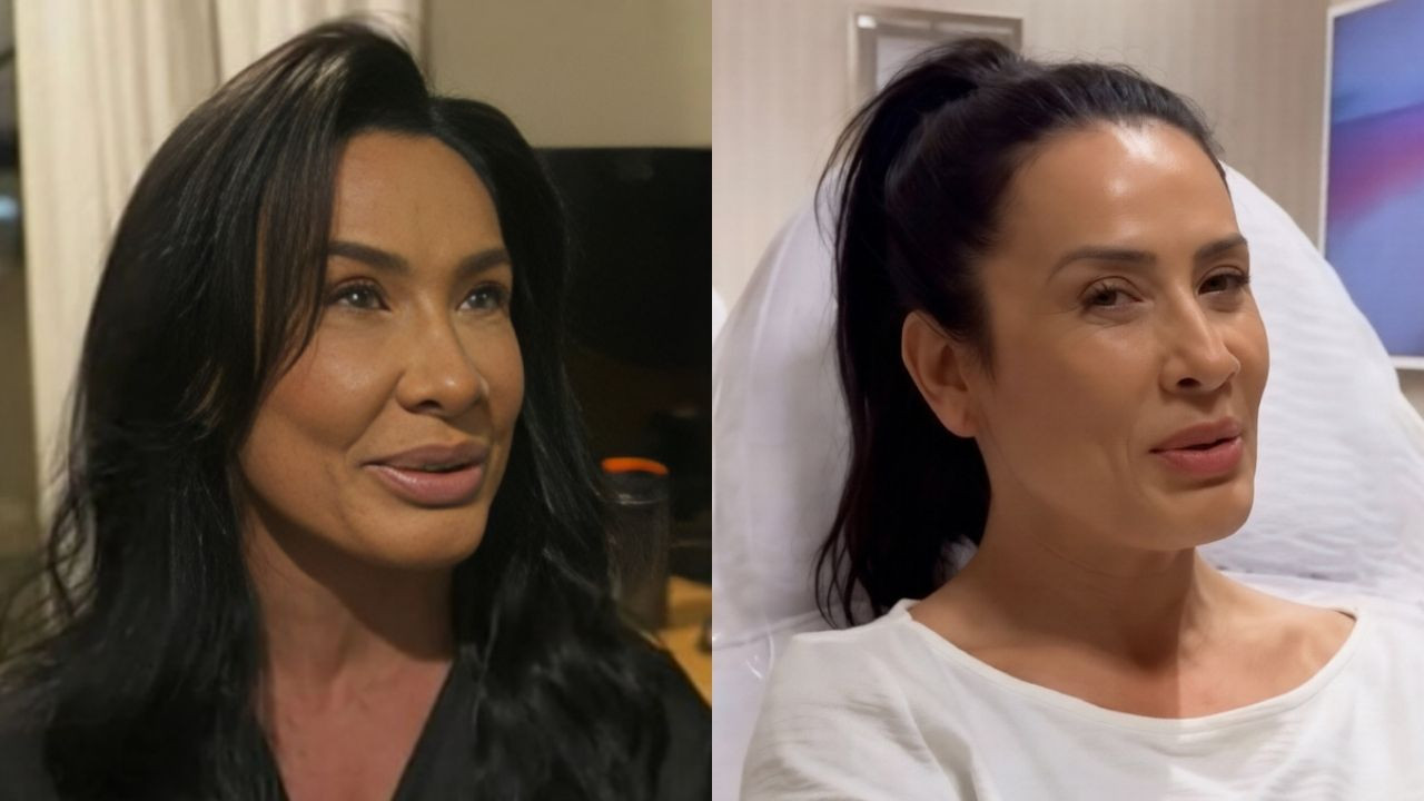 Voltaram atrás: 7 famosas que reverteram procedimentos faciais