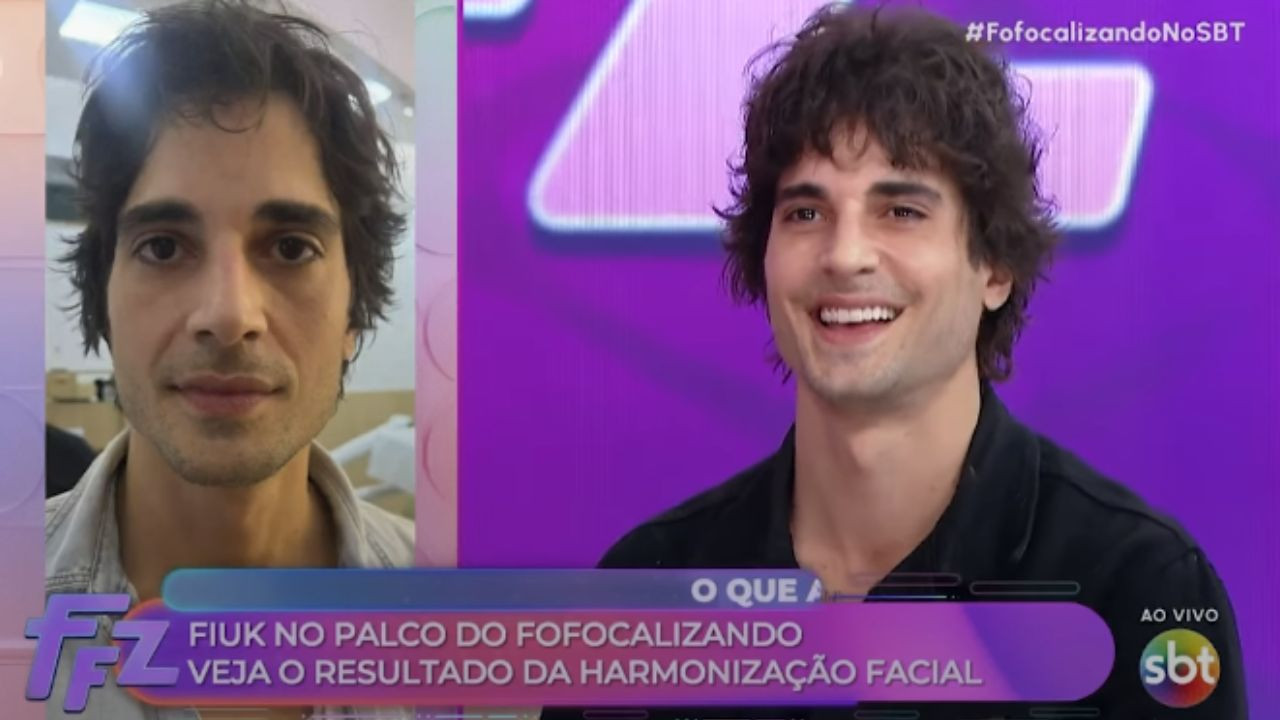 Fiuk surge após harmonização facial e resultado repercute: \"Estava precisando\"