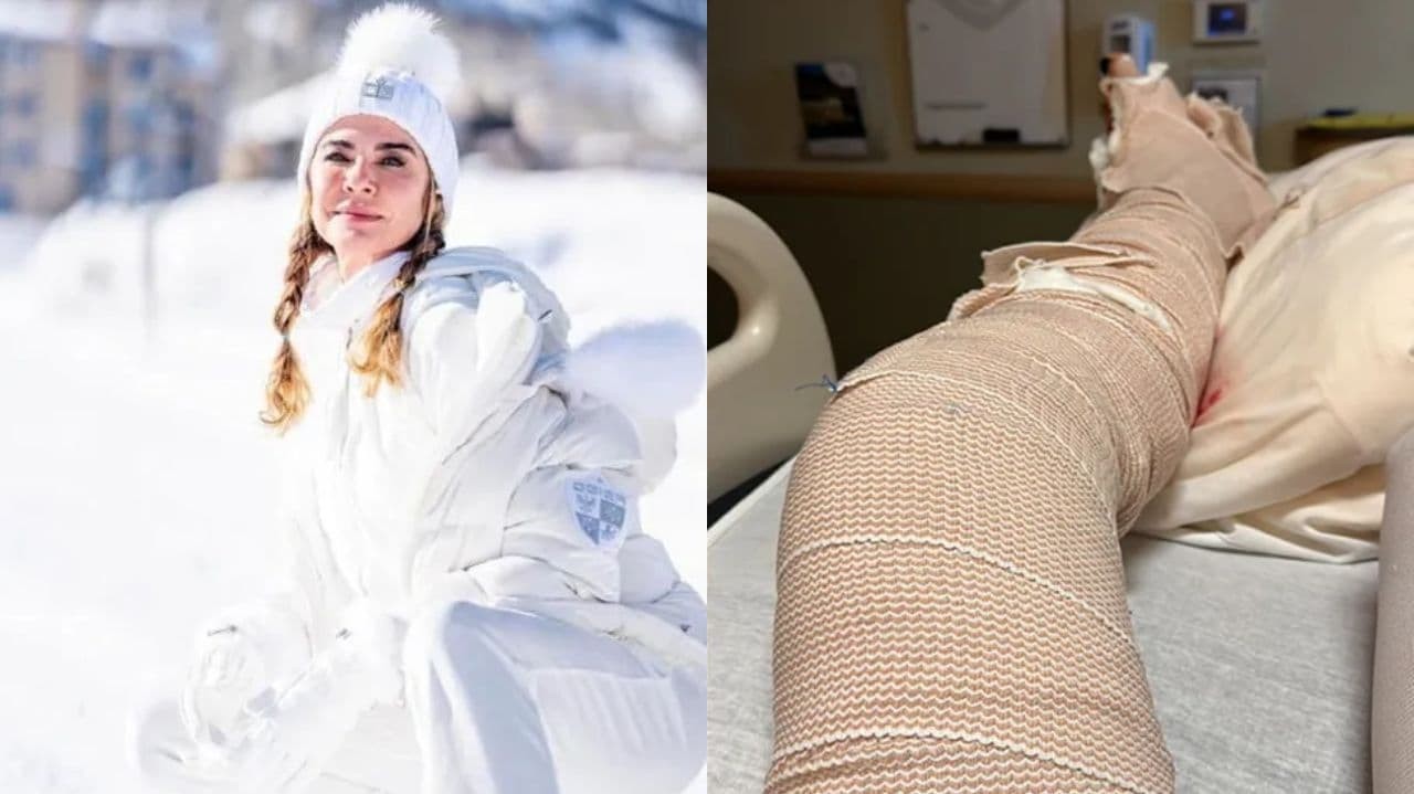 Montagem de fotos de Luciana Gimenez posando na neve e de perna fraturada em hospital