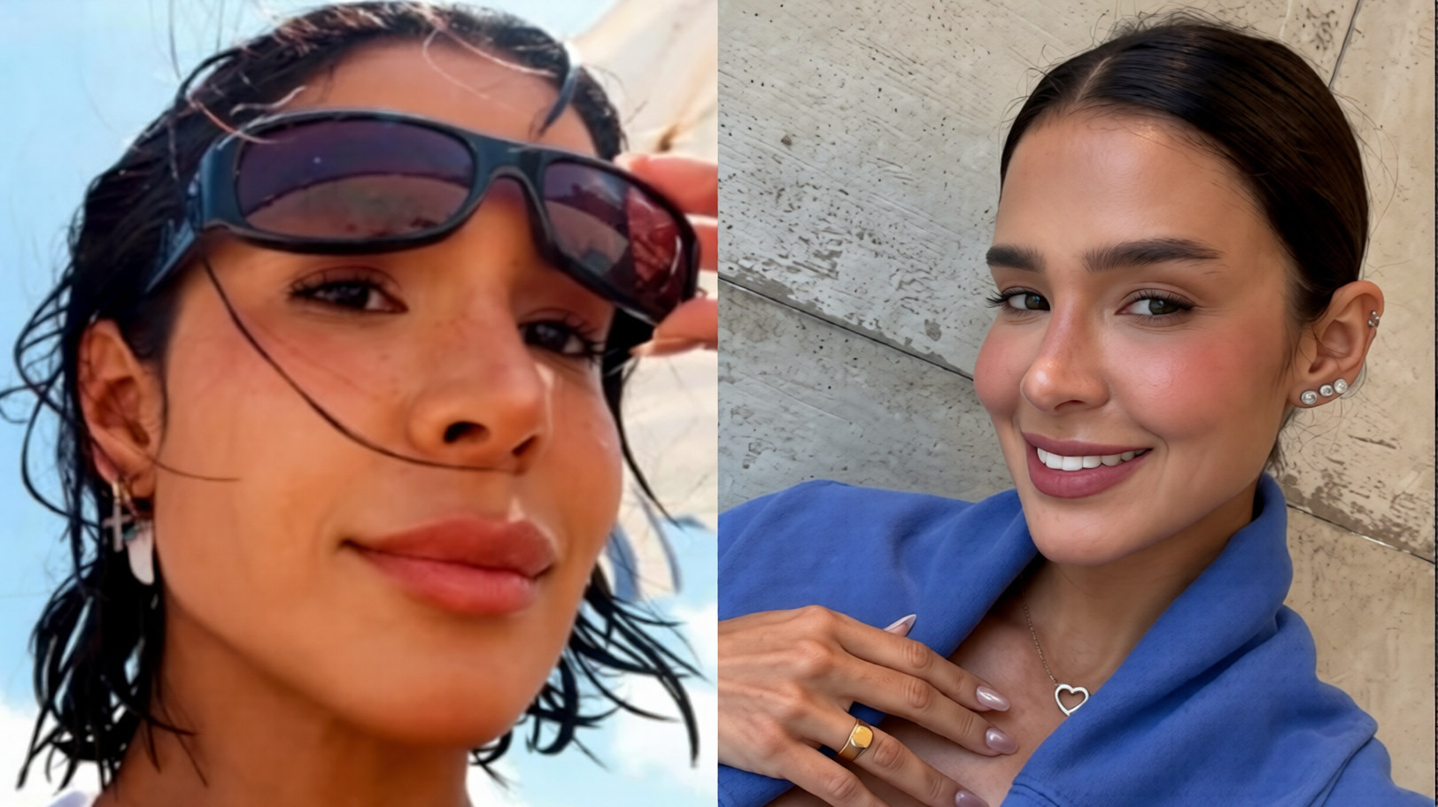 Voltaram atrás: 7 famosas que reverteram procedimentos faciais