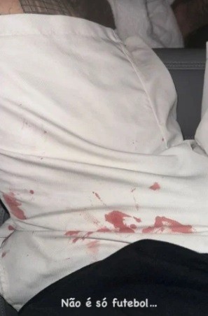 Luan do Corinthians toma esculacho da torcida no motel, APANHA FEIO e exibe roupa cheia de sangue
