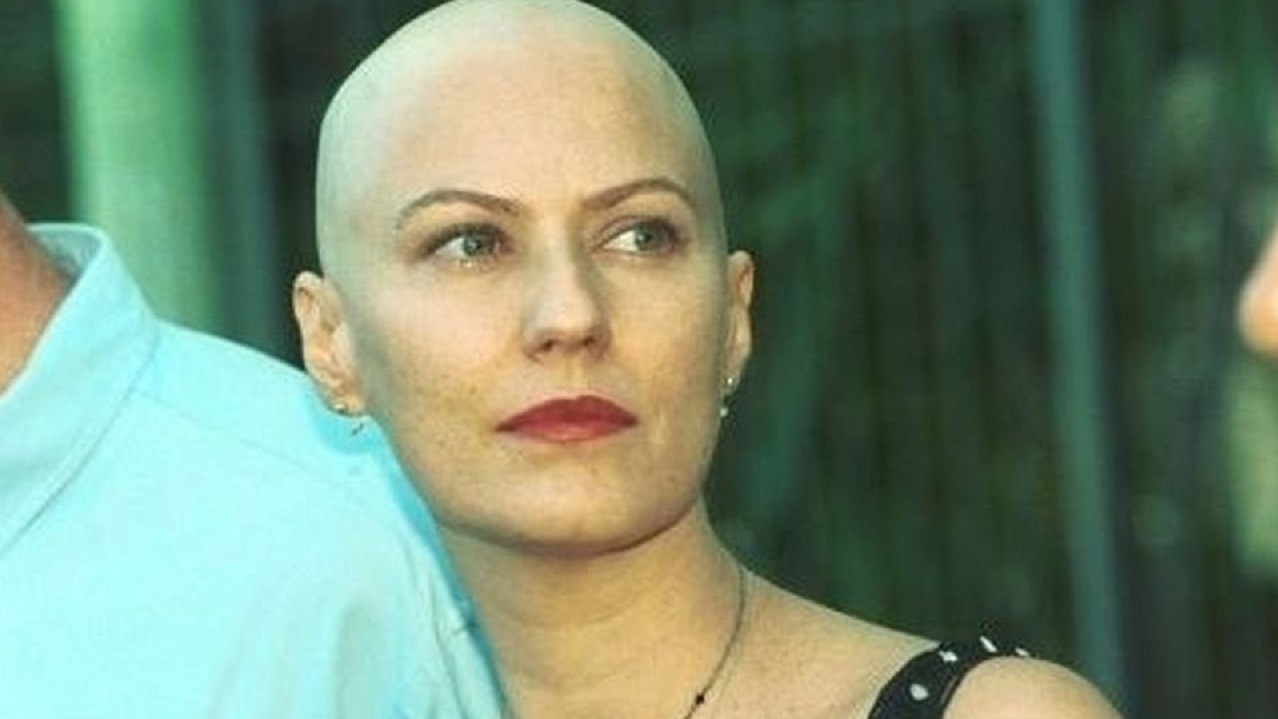Força, Ana Beatriz Nogueira: 12 famosos que venceram o câncer