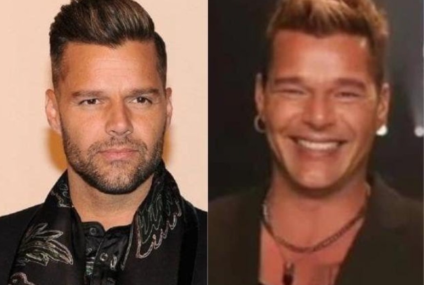 Marcos Mion fica em choque com transformação no rosto de Ricky Martin: \"Triste\"