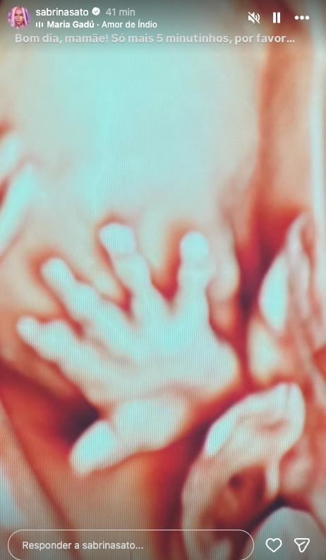 Sabrina Sato exibe ultrassom de bebê; veja foto