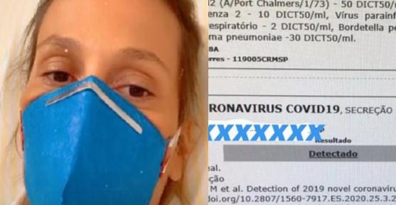 Luisa Mell e teste do coronavírus