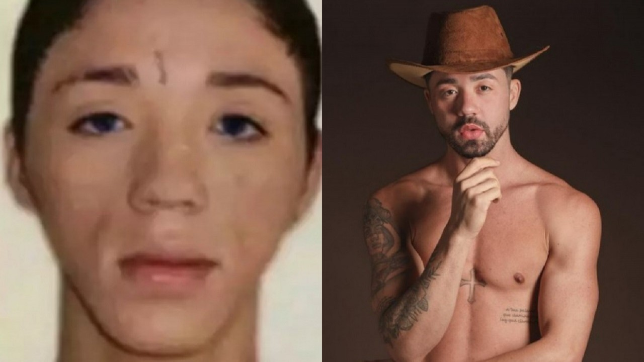 Antes e depois de Rico Melquiades, aos 16 anos e atualmente, após procedimentos estéticos no rosto