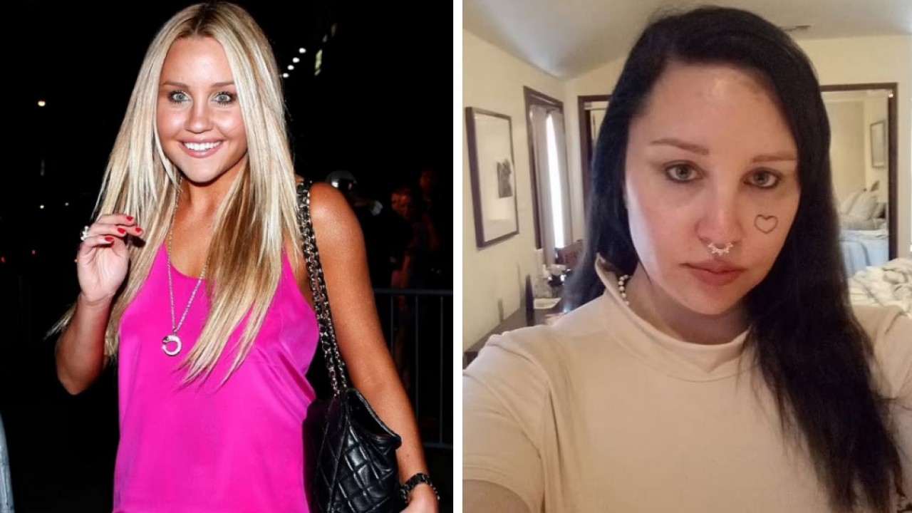 Amanda Bynes antes e depois