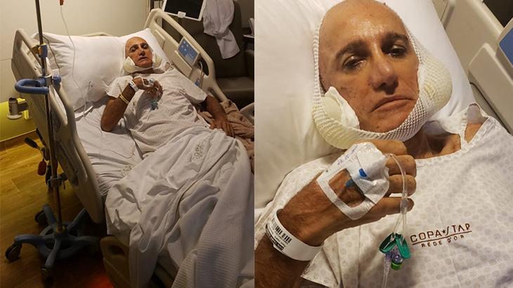 Amin Khader faz nova cirurgia: \"O meu rosto afundou um pouco\"
