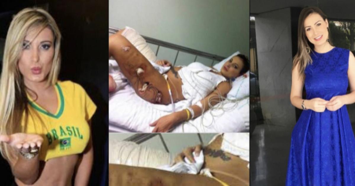 6 famosos brasileiros que fizeram e sofreram com cirurgias plásticas