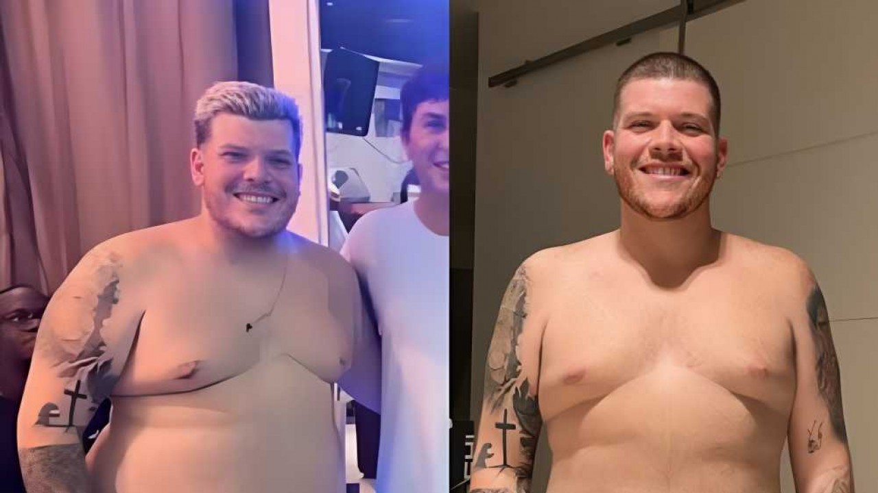 Antes e depois de Ferrugem após perda de peso