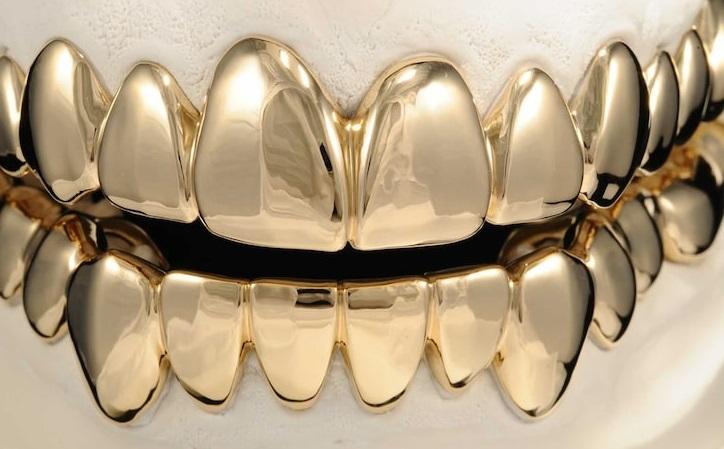Chris Brown compra dentes de ouro por mais de meio milhão de reais